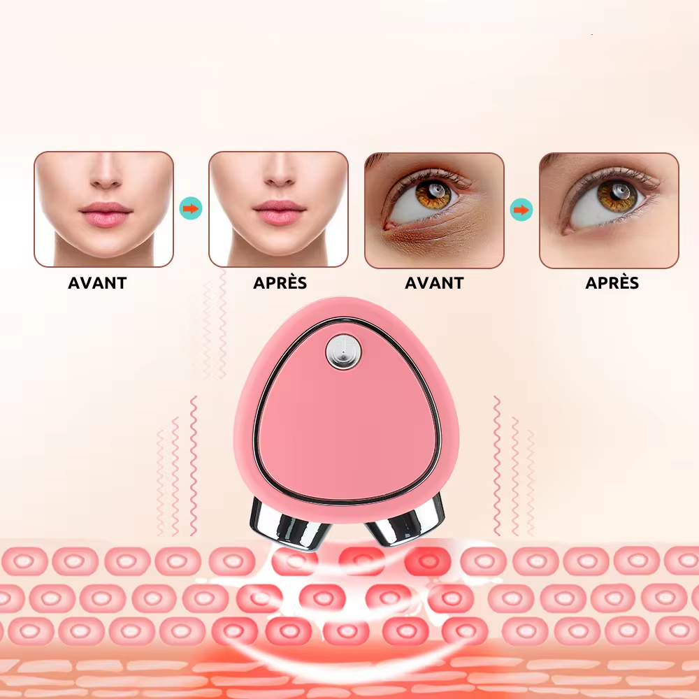 MicroLift Visage